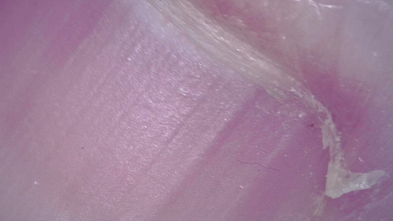 Podiatry microscopy sample image 7