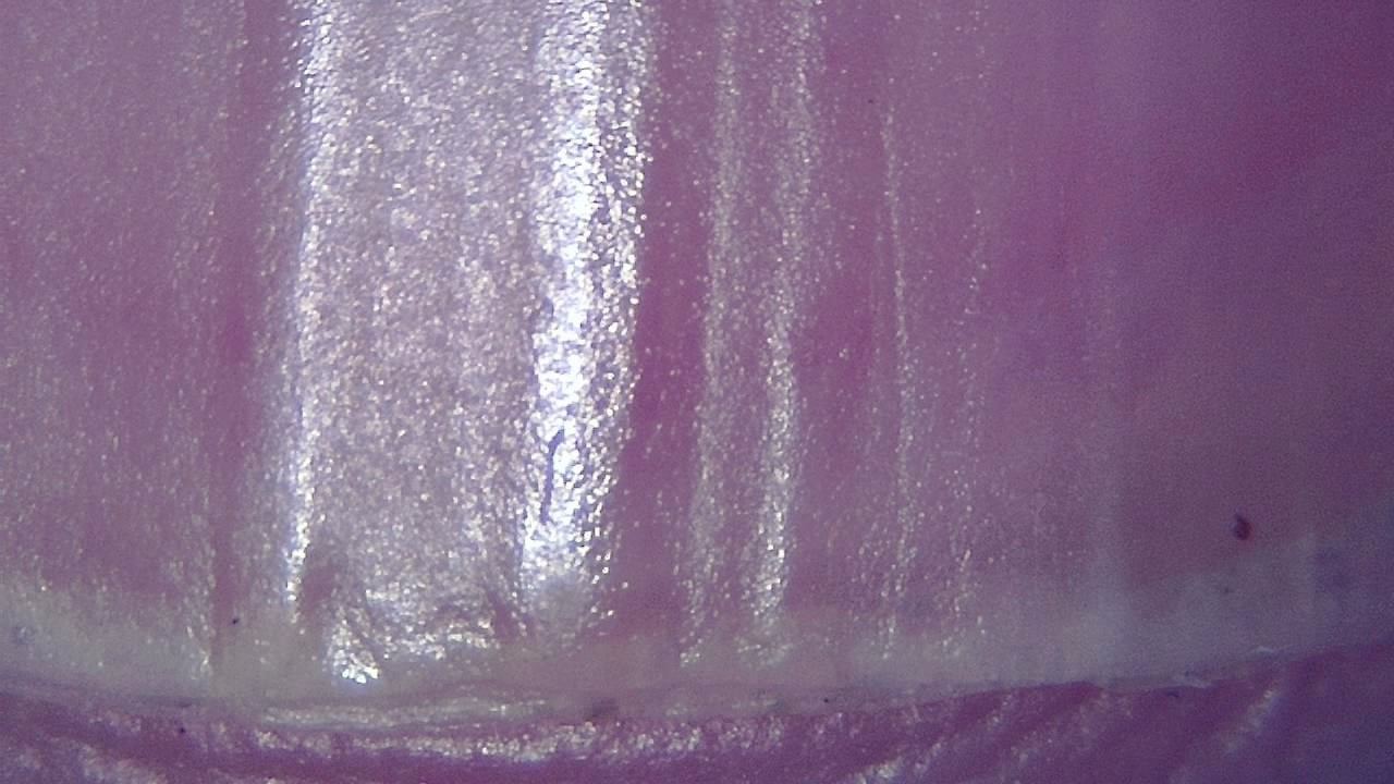 Podiatry microscopy sample image 10