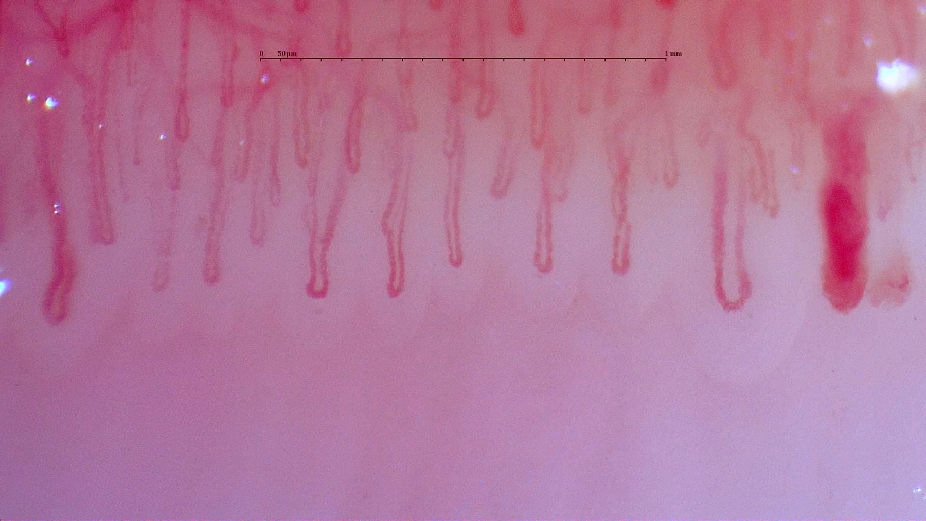 Nailfold Capillaroscopy microscopy sample image 1