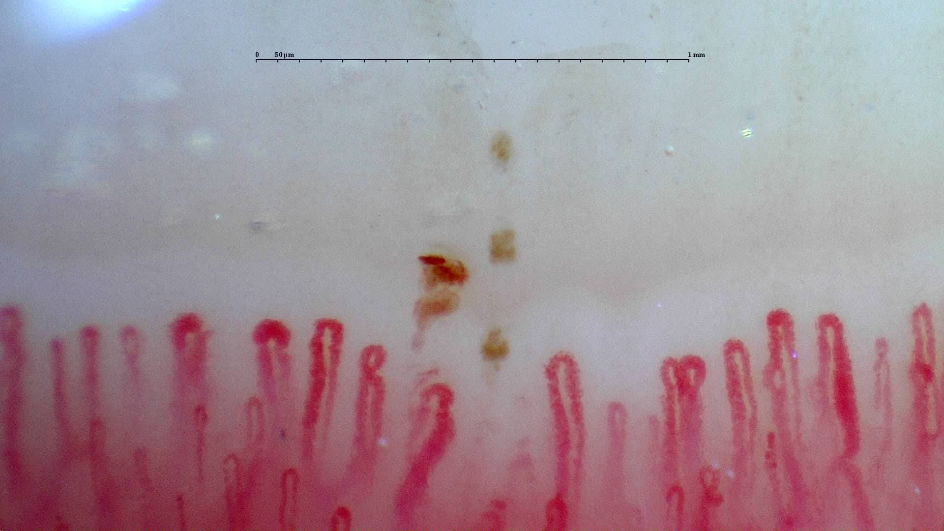 Nailfold Capillaroscopy microscopy sample image 4
