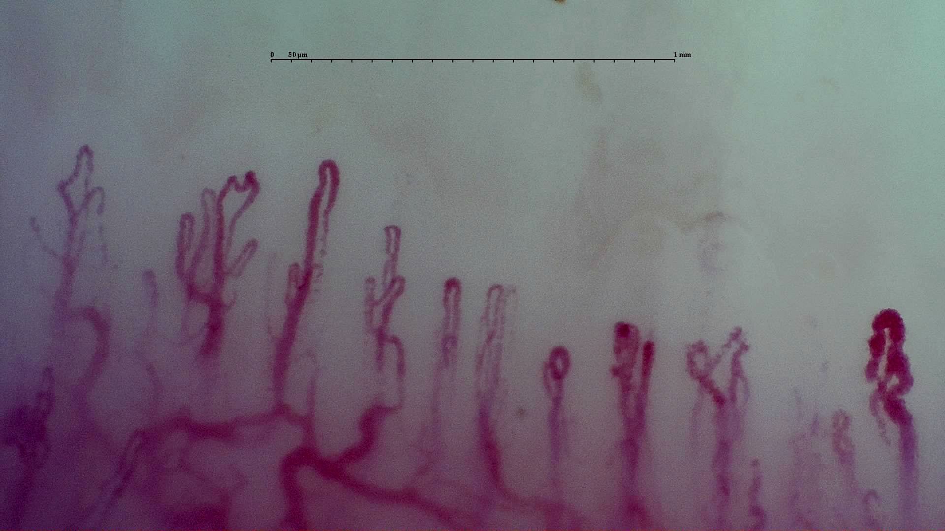 Nailfold Capillaroscopy microscopy sample image 7
